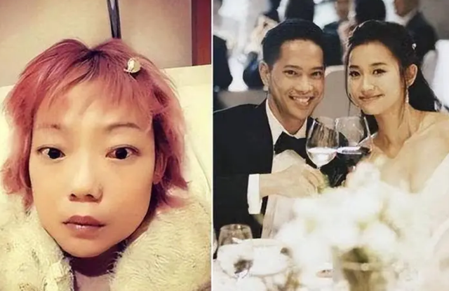 豪门婚姻8年噩梦:名模沦为玩物,牙齿全脱落,不足80斤形似骷髅