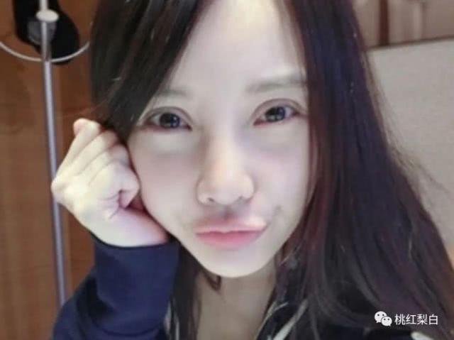 镰刀割出来的大眼双眼皮美女,真没有周冬雨有灵气