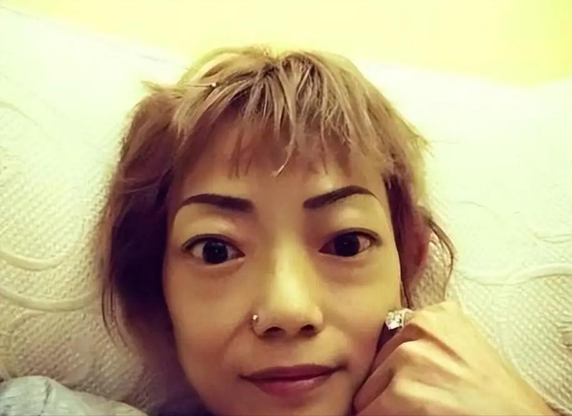豪门婚姻8年噩梦:名模沦为玩物,牙齿全脱落,不足80斤形似骷髅