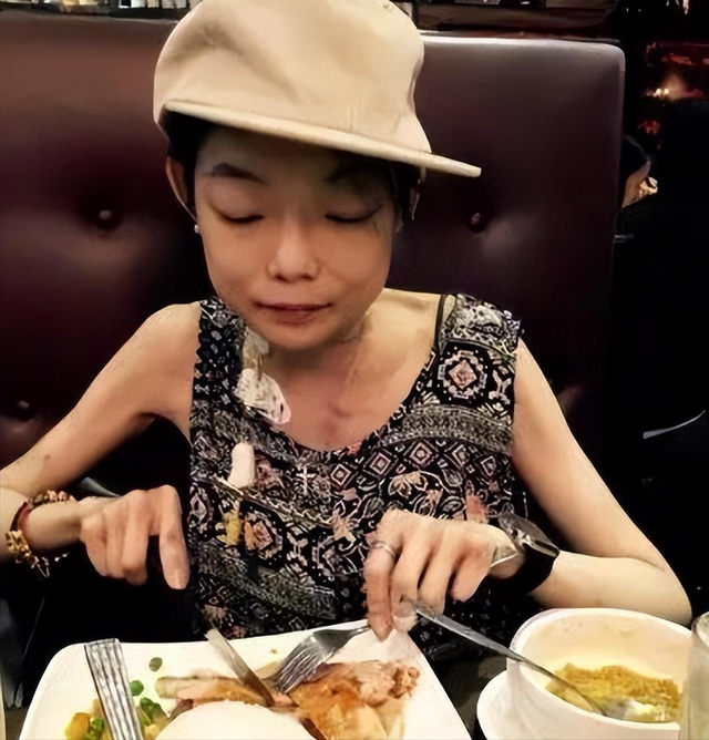 豪门婚姻8年噩梦:名模沦为玩物,牙齿全脱落,不足80斤形似骷髅