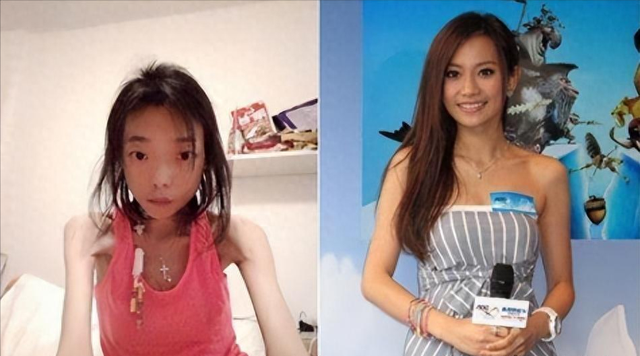 豪门婚姻8年噩梦:名模沦为玩物,牙齿全脱落,不足80斤形似骷髅