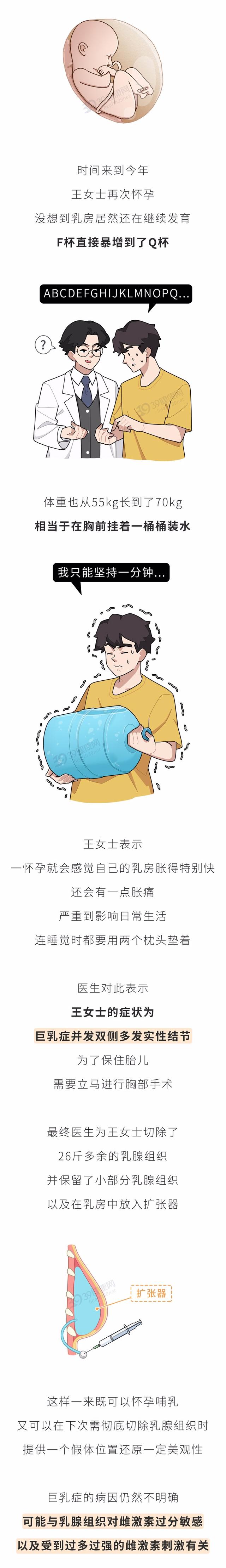 女子怀孕引发巨乳症,医生为她移走“两座大山”,切除26斤组织