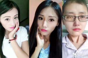 济宁美女癌变(济宁姑娘直播抗癌感动粉丝，网友3千里外来照顾求婚)