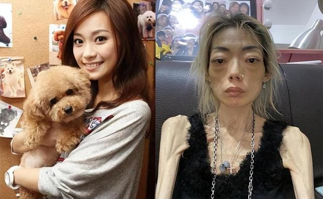 豪门婚姻8年噩梦:名模沦为玩物,牙齿全脱落,不足80斤形似骷髅
