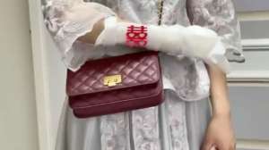 美女头部打石膏(太拼了伴娘打石膏参加闺蜜婚礼：堵门成功，没人敢进)