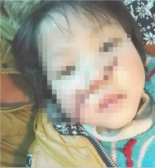 震惊！陕西10岁女孩模仿光头强，竟然用电锯将妹妹鼻子锯开......