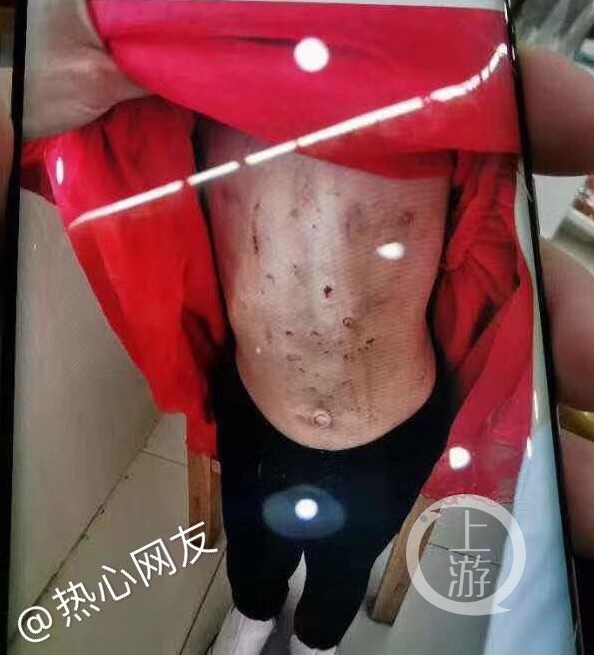 黑龙江虐待4岁女童的继母被关押,律师:涉嫌两项罪名择一重处