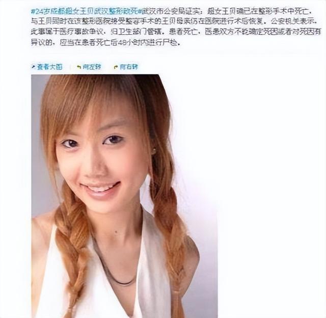 王贝：整容离世真相成谜，主刀医生澄清遭质疑，家属为何选择私了