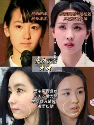 陈都灵整容(陈都灵出道前后对比，差距惊人)