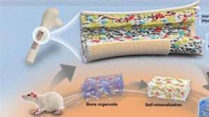 将骨(上海大学团队制备出“骨类器官”,将为骨科手术带来革命)