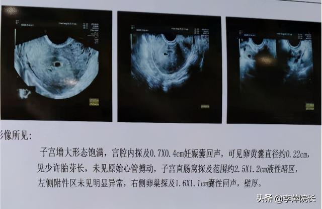 中年丧子,心中痛苦谁人知,再次备孕久久不孕,生活是否还能继续