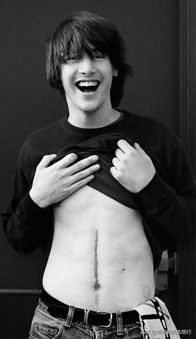 10位名人身上的伤疤由来：有人遇到抢劫，有人演戏受伤