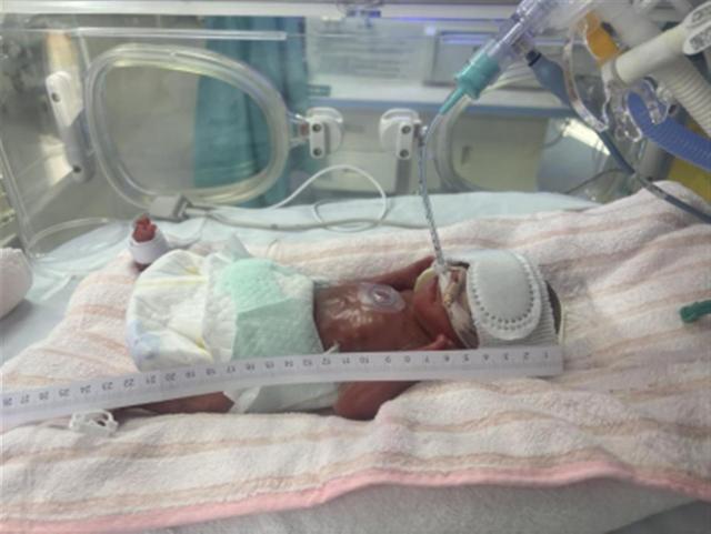 这群医护当起“临时爸妈”,带着“巴掌宝宝”90天闯关创下生命奇迹