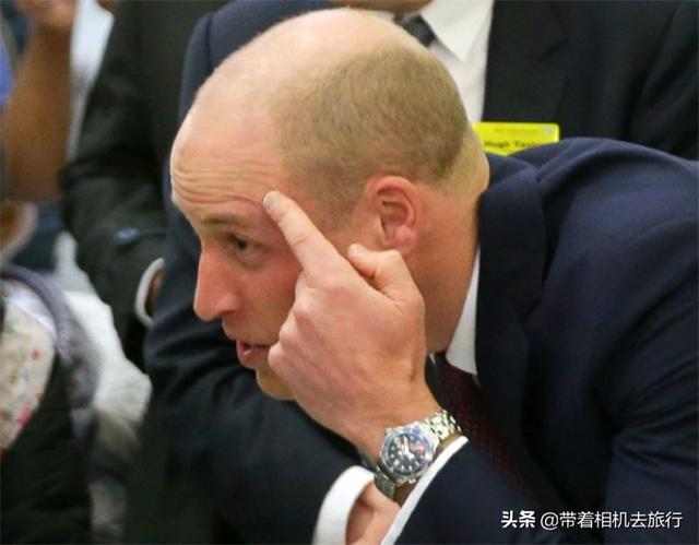 10位名人身上的伤疤由来：有人遇到抢劫，有人演戏受伤