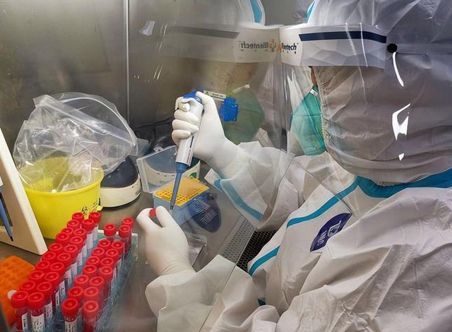 核酸大王张核子,被曝核酸造假,半年敛财4.5亿,今下场大快人心