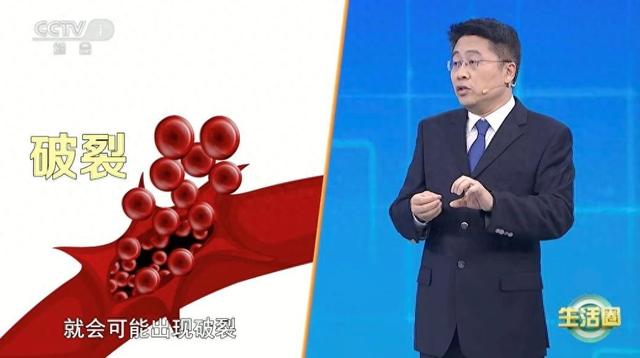 死亡“第一元凶”不是癌症而是它 两个方法帮你远离