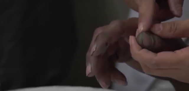 2021小伙喝下整瓶百草枯，入院18天状态变好，医生却下达病危通知