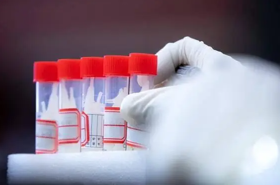 核酸大王张核子,被曝核酸造假,半年敛财4.5亿,今下场大快人心