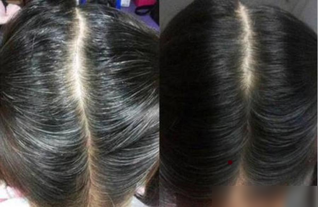 白发太多染黑显老气，试试这几种时尚发色吧，减龄显白又洋气