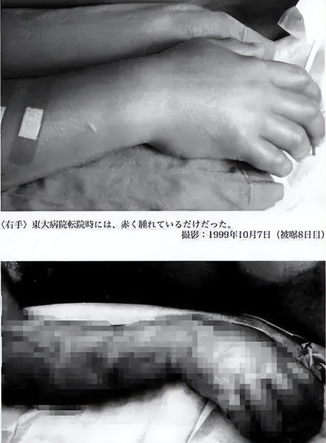 日本男子惨遭核辐射,被日方当做样本强行续命,经历83天地狱折磨