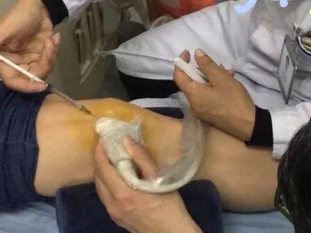 特写｜一道5厘米的膝盖疤痕，一位重返巅峰的战士马龙