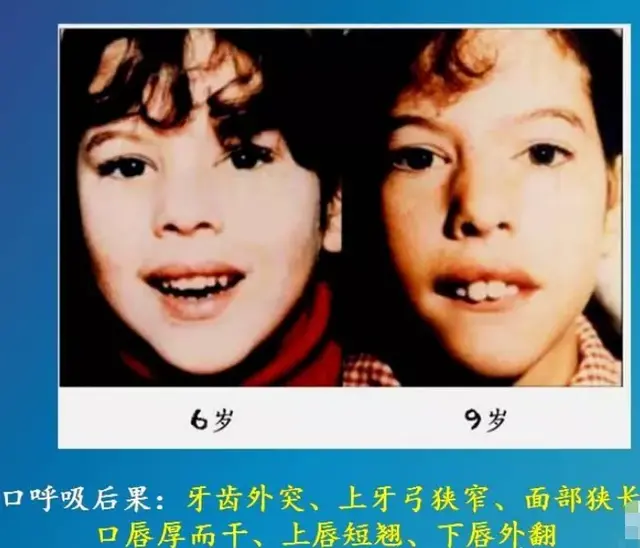 鞠婧祎罕见旧照曝光，面目扁平发量少被队友艳压，三人变化有点大