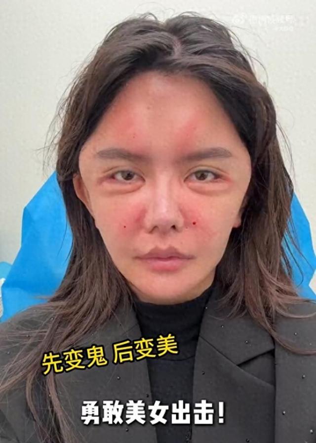 韩安冉N次整容后晒无美颜照，网友调侃：这不是“申公豹”吗？