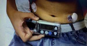 突然爱(杭州10岁男孩4个月瘦了20斤，还总爱喝水，一查竟是这种病医生提醒：别大意，这样的孩子越来越