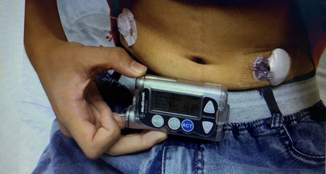 杭州10岁男孩4个月瘦了20斤，还总爱喝水，一查竟是这种病！医生提醒：别大意，这样的孩子越来越多……