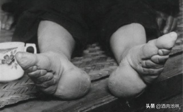 中国历史上“三寸金莲”这一陋习有多残忍？它起源于哪个朝代？