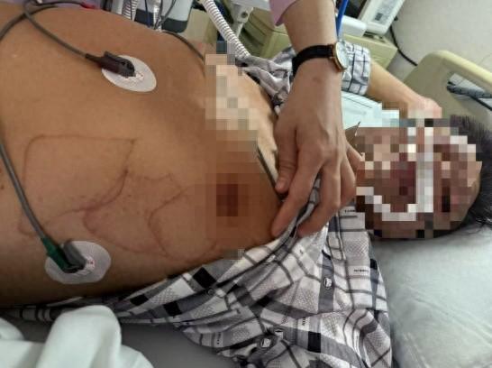 他心脏骤停10分钟，只因这种锻炼方式……