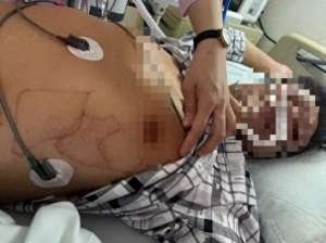 他和他的他(他心脏骤停10分钟，只因这种锻炼方式……)