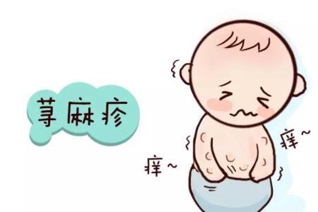 皮肤瘙痒有红疹，就是得了荨麻疹？医生：用一支笔就能自测