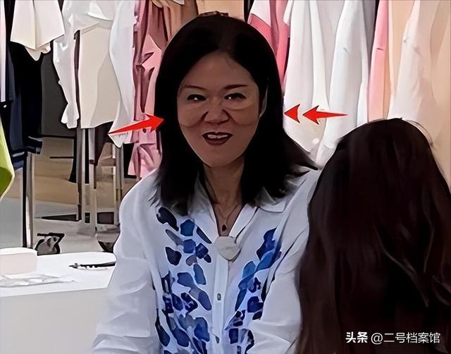 从“铁榔头”到“整容狂魔”，64岁医美失败的郎平，近况令人感叹