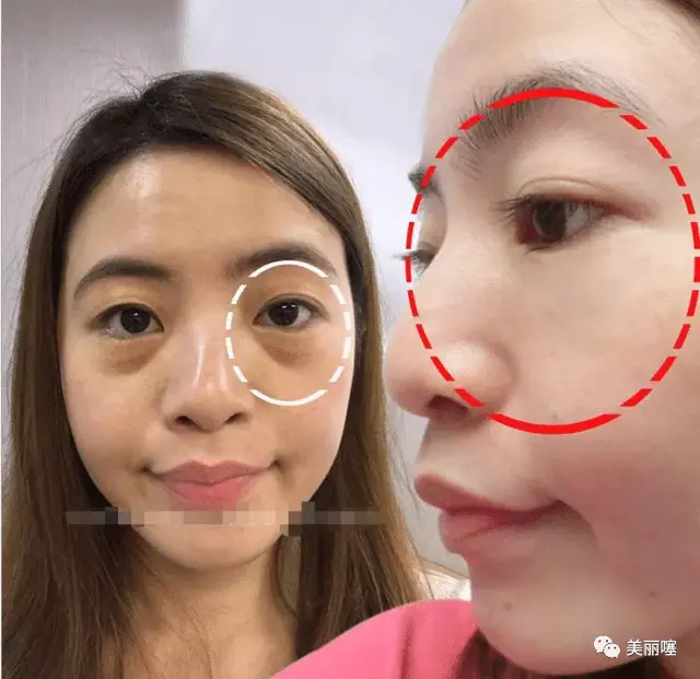 女人脸上若有3个特征,是直男眼中的“丑女”,中1个都很难补救