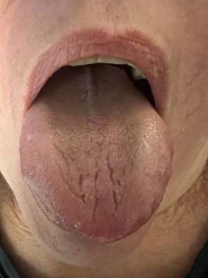 五门(黄贵生：五门针法，治疗子宫下垂)