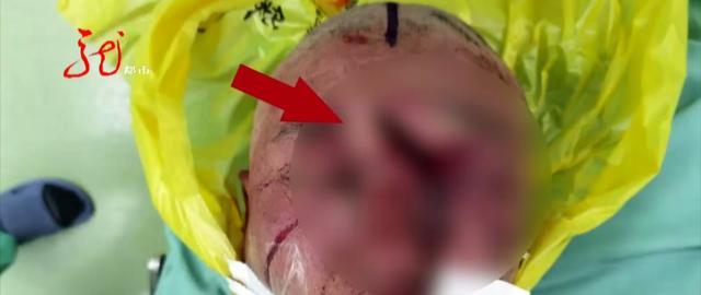 “你瞅啥?”“瞅我就顶你!”黑龙江一男子被顶出个血窟窿……