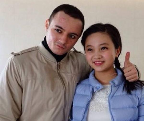 著名童星阿尔法18岁“秃顶”颜值堪忧,如今植发成功帅出新高度