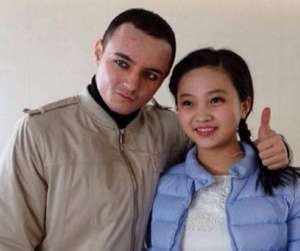 脱发照片(著名童星阿尔法18岁“秃顶”颜值堪忧，如今植发成功帅出新高度)