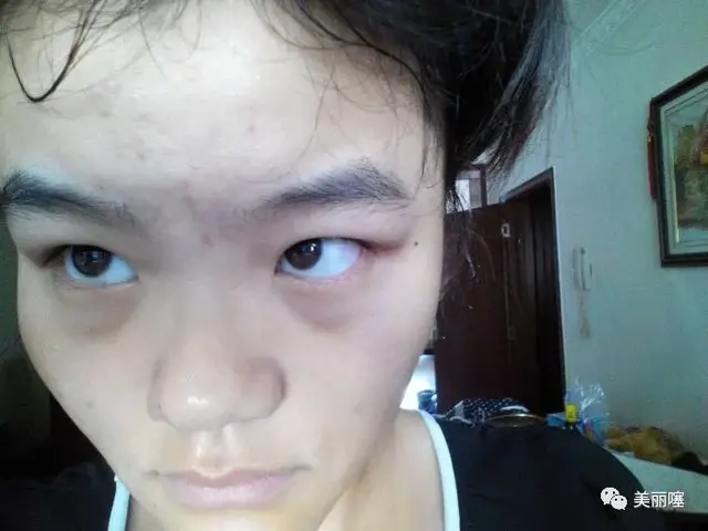 女人脸上若有3个特征,是直男眼中的“丑女”,中1个都很难补救