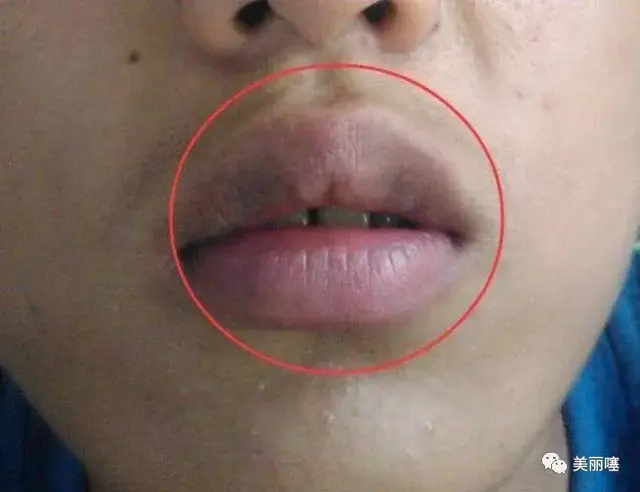 女人脸上若有3个特征,是直男眼中的“丑女”,中1个都很难补救