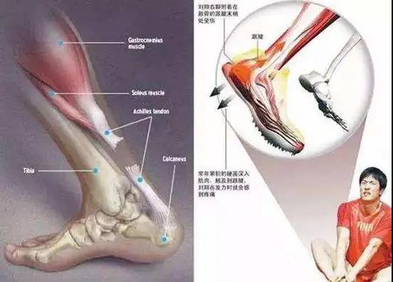 易建联重伤离场,网友:一个时代真的要结束了?
