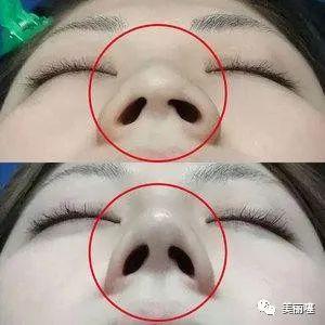 女人脸上若有3个特征,是直男眼中的“丑女”,中1个都很难补救