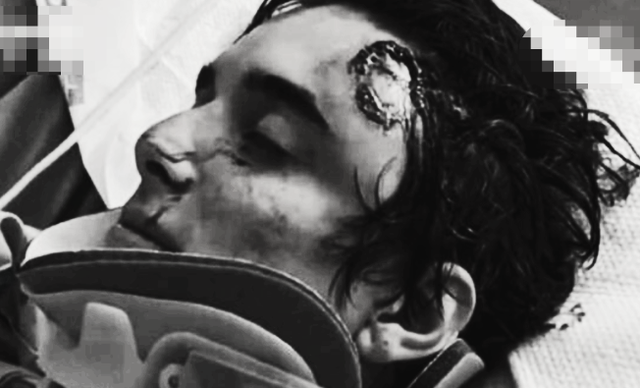 1998年美国温顺杂交犬深夜将女主人折磨致死，调查后原因令人心酸