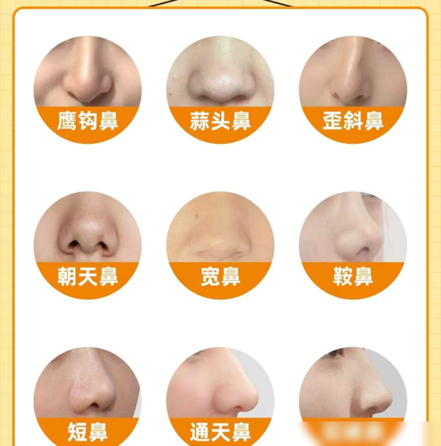 “蒜头鼻”对颜值影响有多大？看完这几组对比图后，你就知道了
