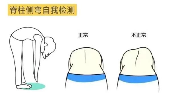 女演员走路姿势被指残疾,本人回应:已经10年了