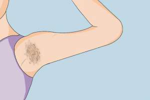 露毛图片(为什么别人腋下光秃秃,你却长了很多腋毛?到底应不应该刮?)