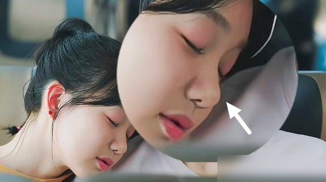 “蒜头鼻”对颜值影响有多大？看完这几组对比图后，你就知道了