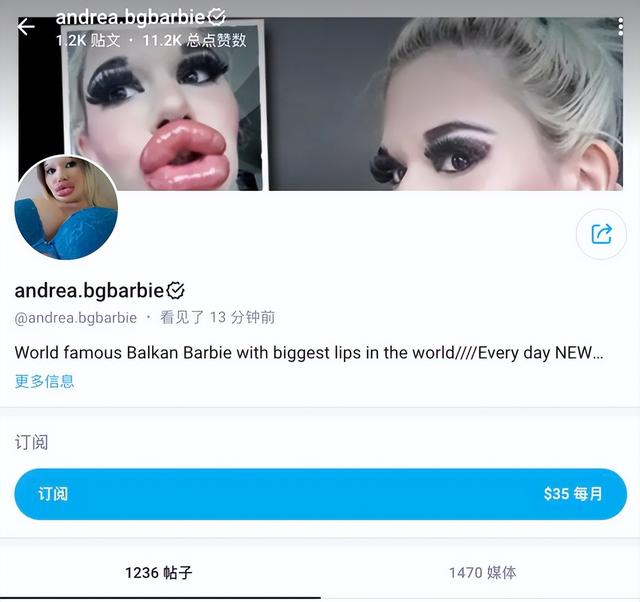 女子痴迷丰唇成为全球嘴唇最厚网红,拍卖自己的厚唇热吻