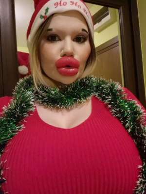 厚唇(女子痴迷丰唇成为全球嘴唇最厚网红,拍卖自己的厚唇热吻)